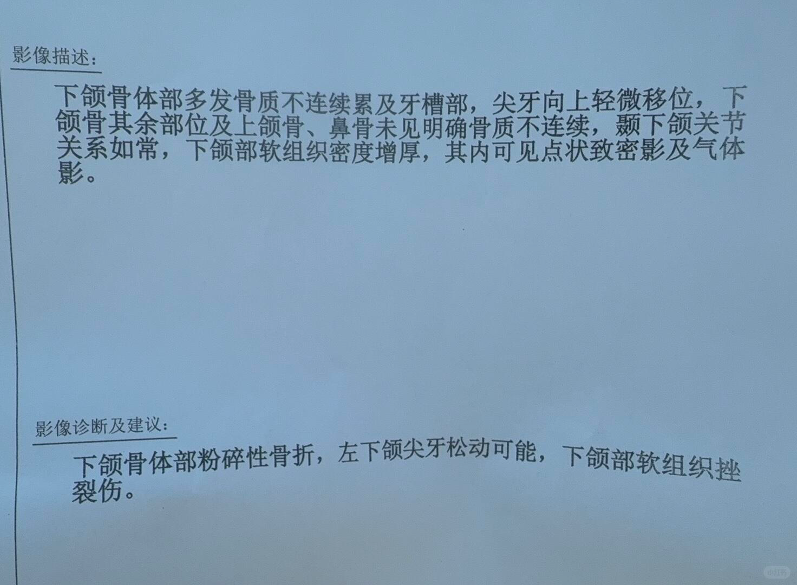 李先生公开的影像诊断书
